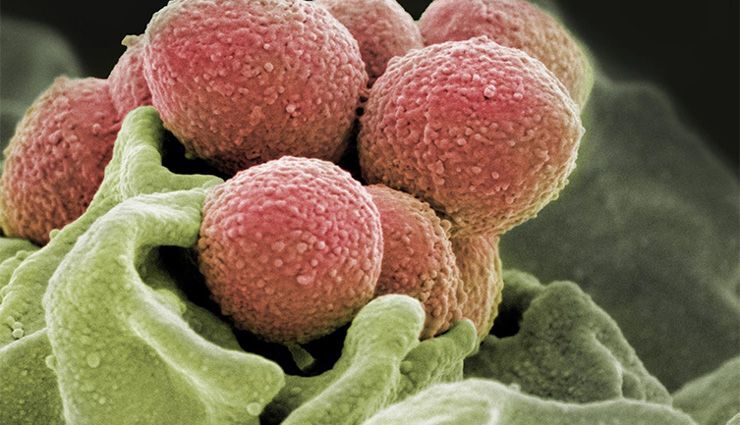 شیوع بیماری مرگبار «باکتری گوشتخوار» | این باکتری در عرض دو روز انسان را می‌کشد!