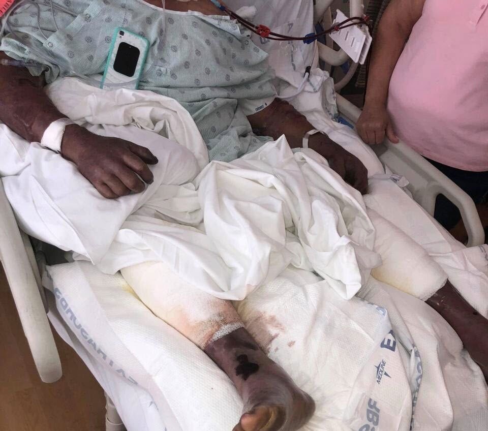 (تصاویر +18) بلای هولناکی که بیماری «گوشتخوار» بر سر انسان می‌آورد