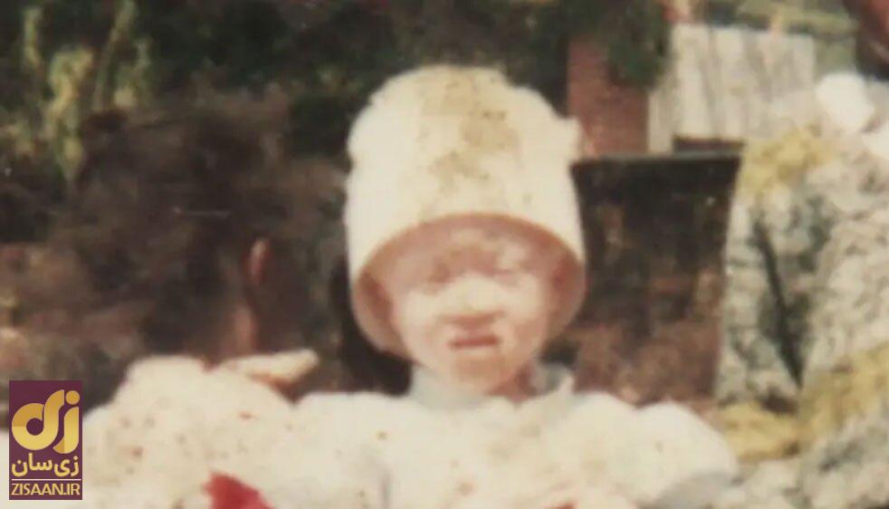 داستان تلخ یک زن؛ تجاوز به فرد مبتلا به زالی باعث طول عمر می‌شود!