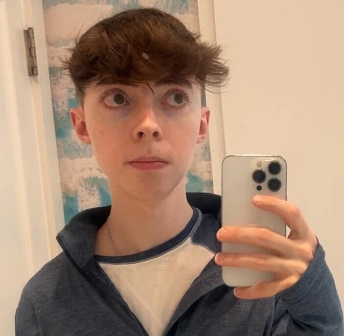 مرد ۳۵ سالهای که شبیه نوجوانان ۱۵ ساله است مرد ۳۵ سالهای که شبیه نوجوانان ۱۵ ساله است