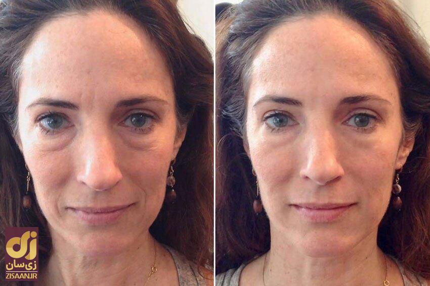 خواص ماساژ صورت چیست؟ خواص ماساژ صورت چیست؟