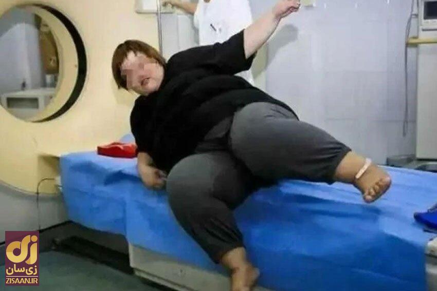 دختر ۲۴ ساله در پخش زنده آن‌قدر غذا خورد تا جلوی چشم همه مُرد!