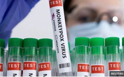 هشدار سازمان جهانی بهداشت درباره سویه جدید ویروس ام-پاکس یا «آبله میمونی» هشدار سازمان جهانی بهداشت درباره سویه جدید ویروس ام-پاکس یا «آبله میمونی»