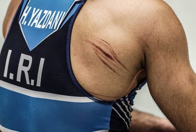 پرده‌برداری پزشک اتحادیه جهانی کشتی از علت عدم‌استفاده از بی‌حسی یا تِیپ برای حسن یزدانی