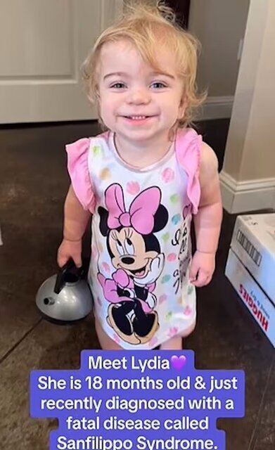 ۸ مورد از نادرترین بیماریهای جهان؛ از سندرم دست بیگانه تا سندرم مُرده متحرک ۸ مورد از نادرترین بیماریهای جهان؛ از سندرم دست بیگانه تا سندرم مُرده متحرک