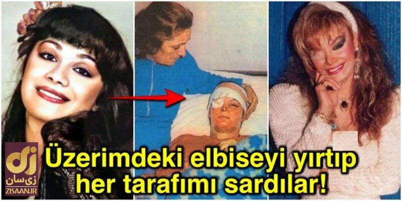 (تصاویر) فیلم سینمایی ترکی برگن؛ داستان تکان‌دهنده قتل وحشیانه خواننده مشهور زن ترک