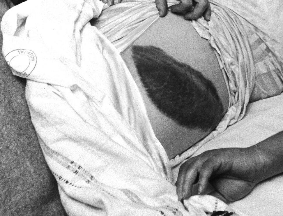 عکس | اولین زنی که ضربه شهاب‌سنگ را تجربه کرد!