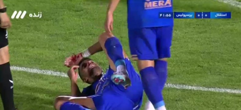 اتفاق کمسابقه: خونریزی شدید سه بازیکن استقلال! اتفاق کمسابقه: خونریزی شدید سه بازیکن استقلال!