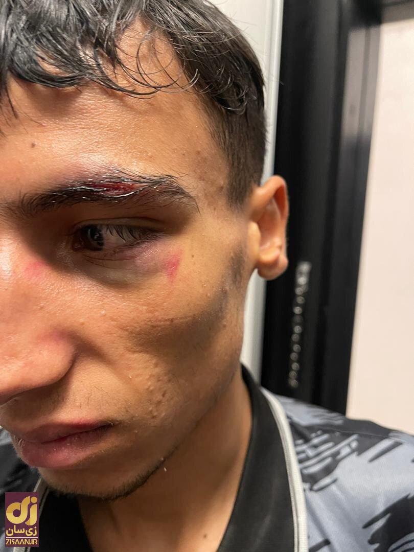 عکس | حرکت غیرورزشی بوکسور افغانستانیدر برابر حریف ایرانی!