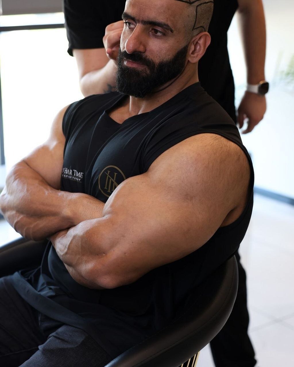 (تصاویر) عکس‌های هادی چوپان پس از کاشت مو در ترکیه