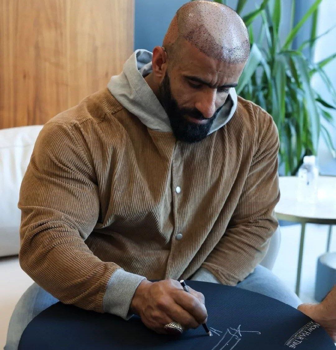 (تصاویر) عکس‌های هادی چوپان پس از کاشت مو در ترکیه