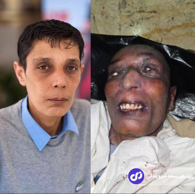 عکس | کشف جسد مازن حماده افشاگر مشهور سوری در زندان مخوف صیدنایا