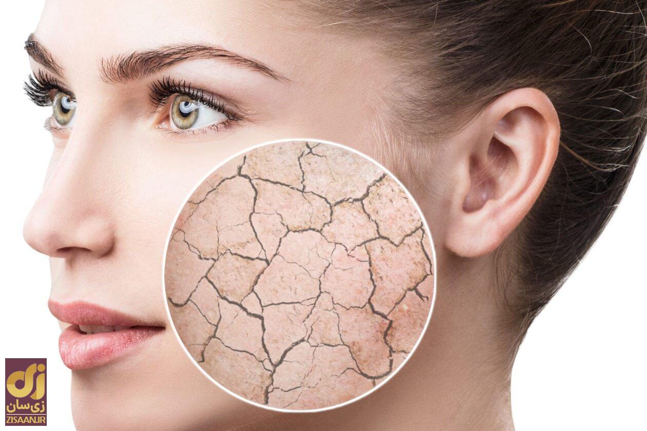 با تزریق این اسید اکسیر جوانی را تزریق و با چین و چروک پوست خداحافظی کنید