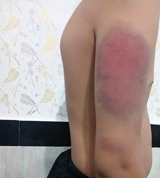 تصاویر تکان‌دهنده از ضرب و شتم دانش‌آموزان با کابل توسط معلم سنندجی!