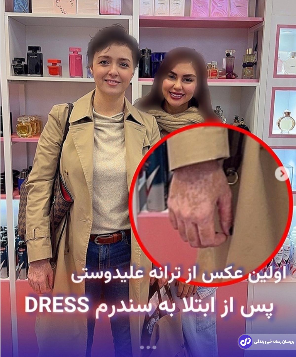 ترانه عیلدوستی