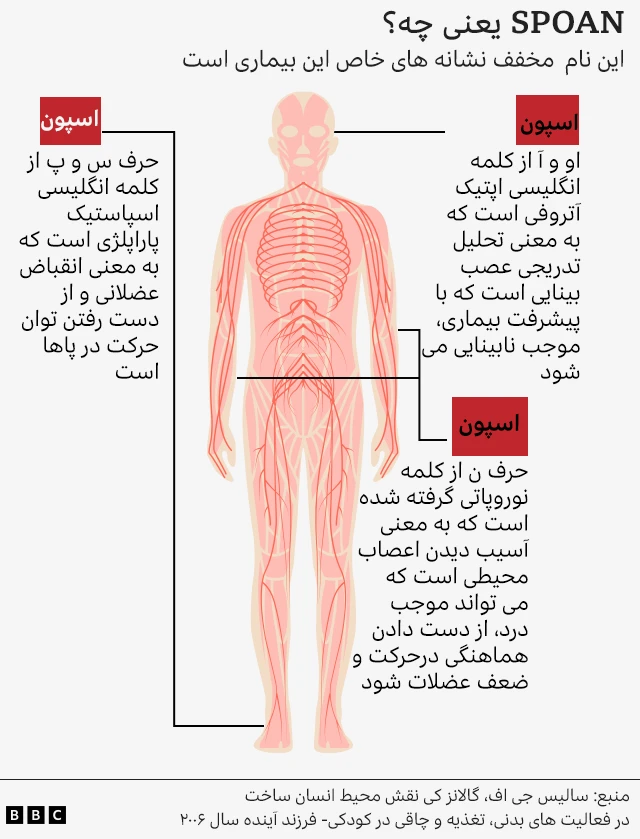 بیماری نادر در شهری دورافتاده که «تمام ساکنان آن پسرعمو و دخترعمو هستند»