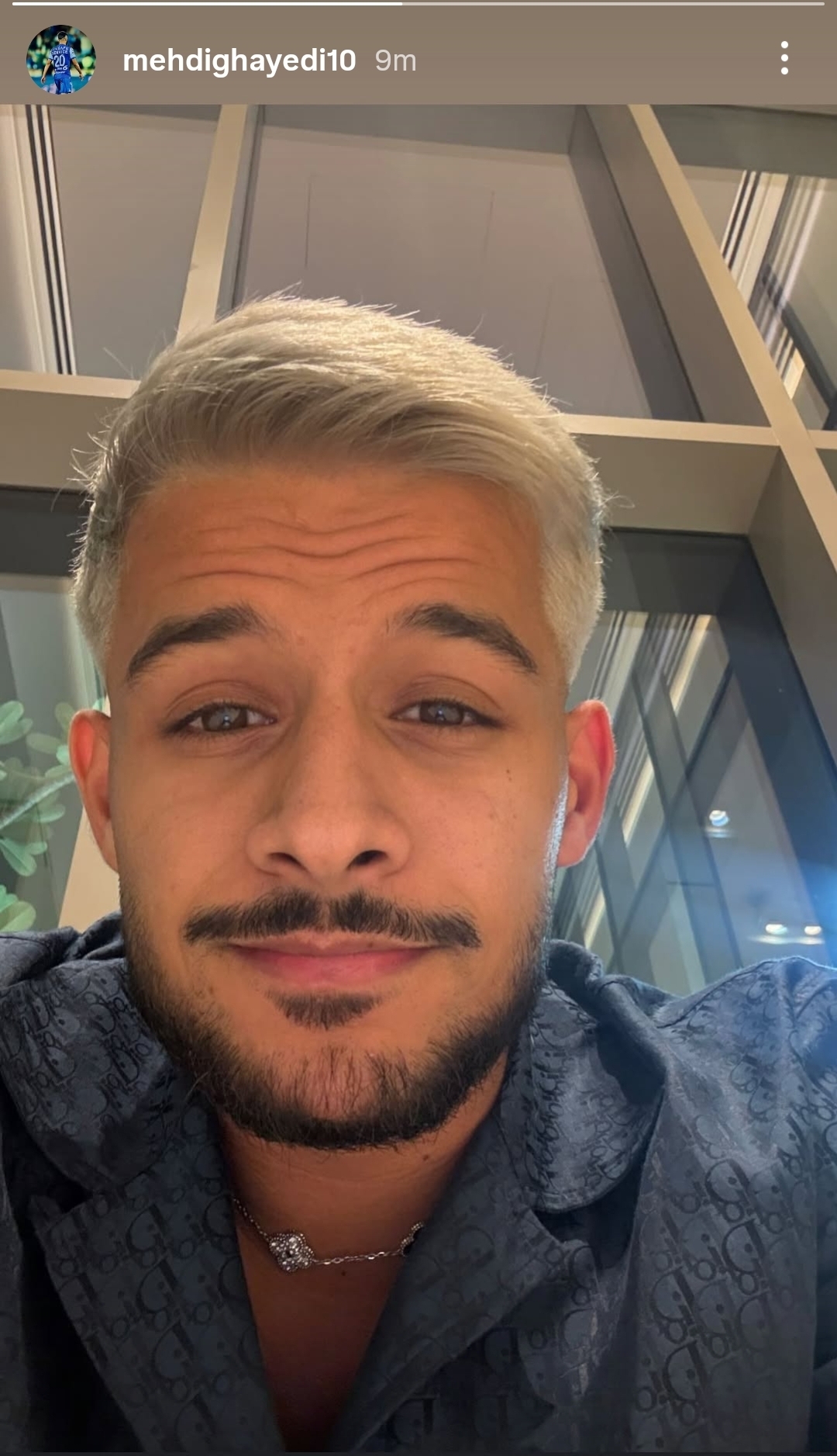 مهدی قایدی از مدل موی جدیدش رونمایی کرد