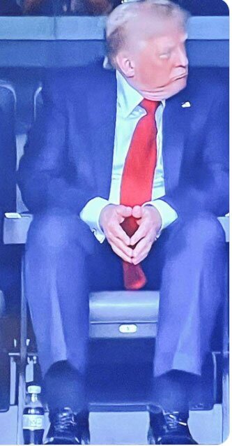 کاخ سفید بیماری ترامپ را فاش کرد؛ نارسایی مزمن وریدی چیست و چقدر خطرناک است؟ کاخ سفید بیماری ترامپ را فاش کرد؛ نارسایی مزمن وریدی چیست و چقدر خطرناک است؟