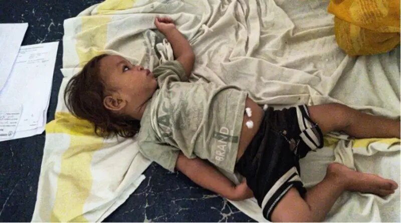 نوزاد هندی با دندان‌هایش مار کبرا را کُشت و خود را نجات داد + تصاویر