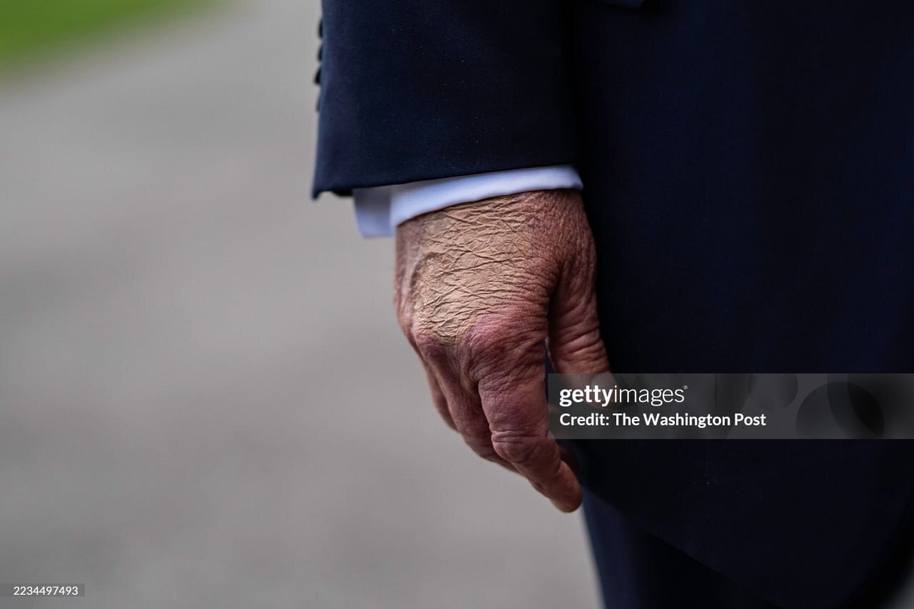 (تصاویر) ترامپ سکته کرد؟!