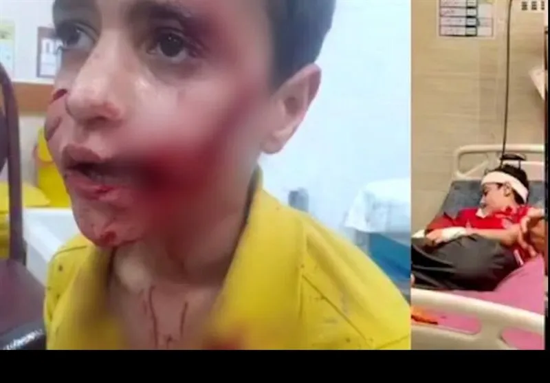 کودک ۱۰ ساله بر اثر حمله سگ‌های ولگرد جان باخت