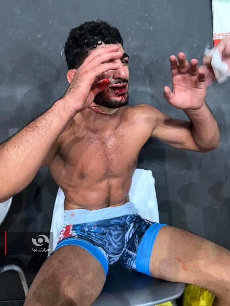 تصاویر | وضعیت دردناک دانیال سهرابی پس از شکست برابر غانم فرانسوی