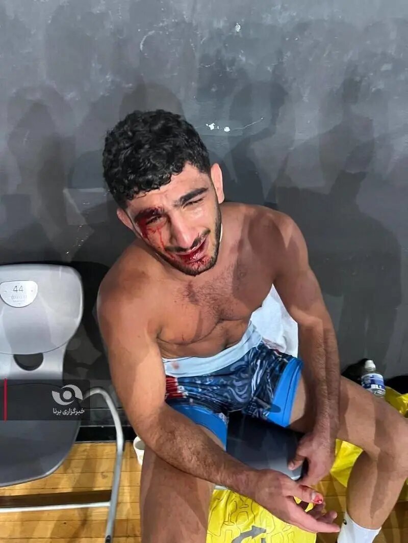 تصاویر | وضعیت دردناک دانیال سهرابی پس از شکست برابر غانم فرانسوی
