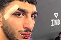 تصاویر | وضعیت دردناک دانیال سهرابی پس از شکست برابر غانم فرانسوی