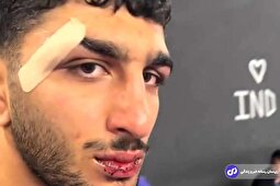 تغییر چهره دانیال سهرابی کشتی‌گیر زخمی ایران برای کسب مدال + ویدئو