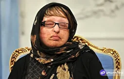 ویدئو | ماجرای نابینا شدن ناگهانی آمنه در اسپانیا به دلیل پول ندادن احمدی‌نژاد