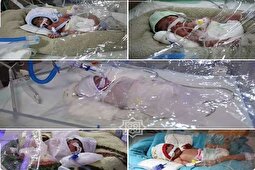 مادر متولد ۱۳۷۹،‌ پنج‌قلو به دنیا آورد + عکس