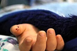 ماجرای تلخ امیر عباس کودک ۴ ساله‌ای که قربانی کودک آزاری شد! + ویدئو