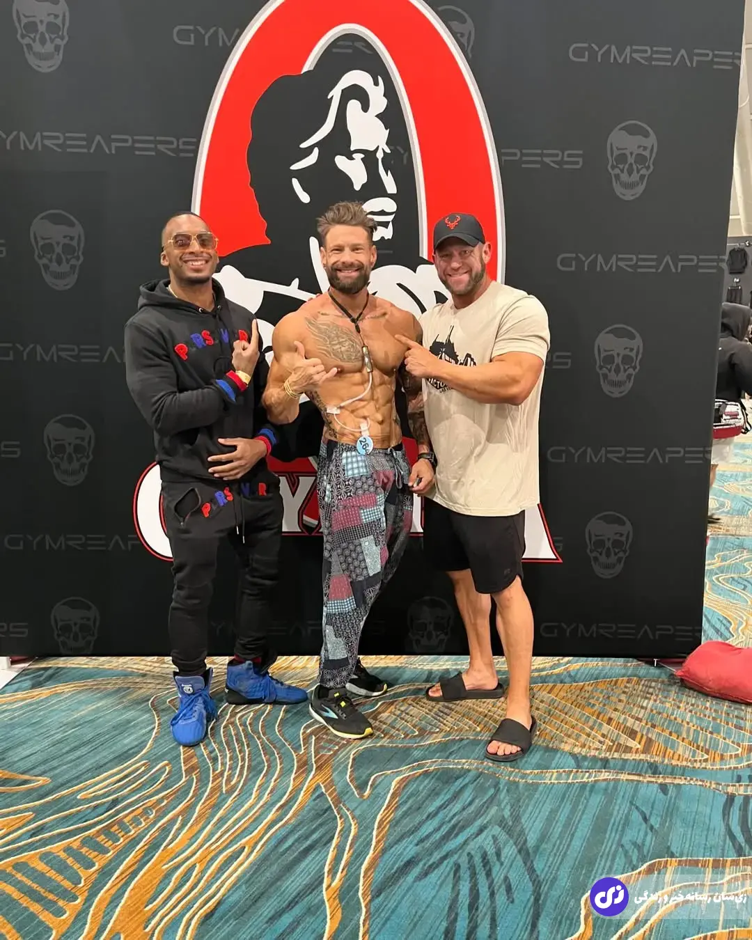 مکس اَمزدن؛ بدنسازی که با تجهیزات دیالیز و نارسایی کلیوی روی استیج رفت و در دسته فیزیک کلاسیک فیگور گرفت مکس اَمزدن