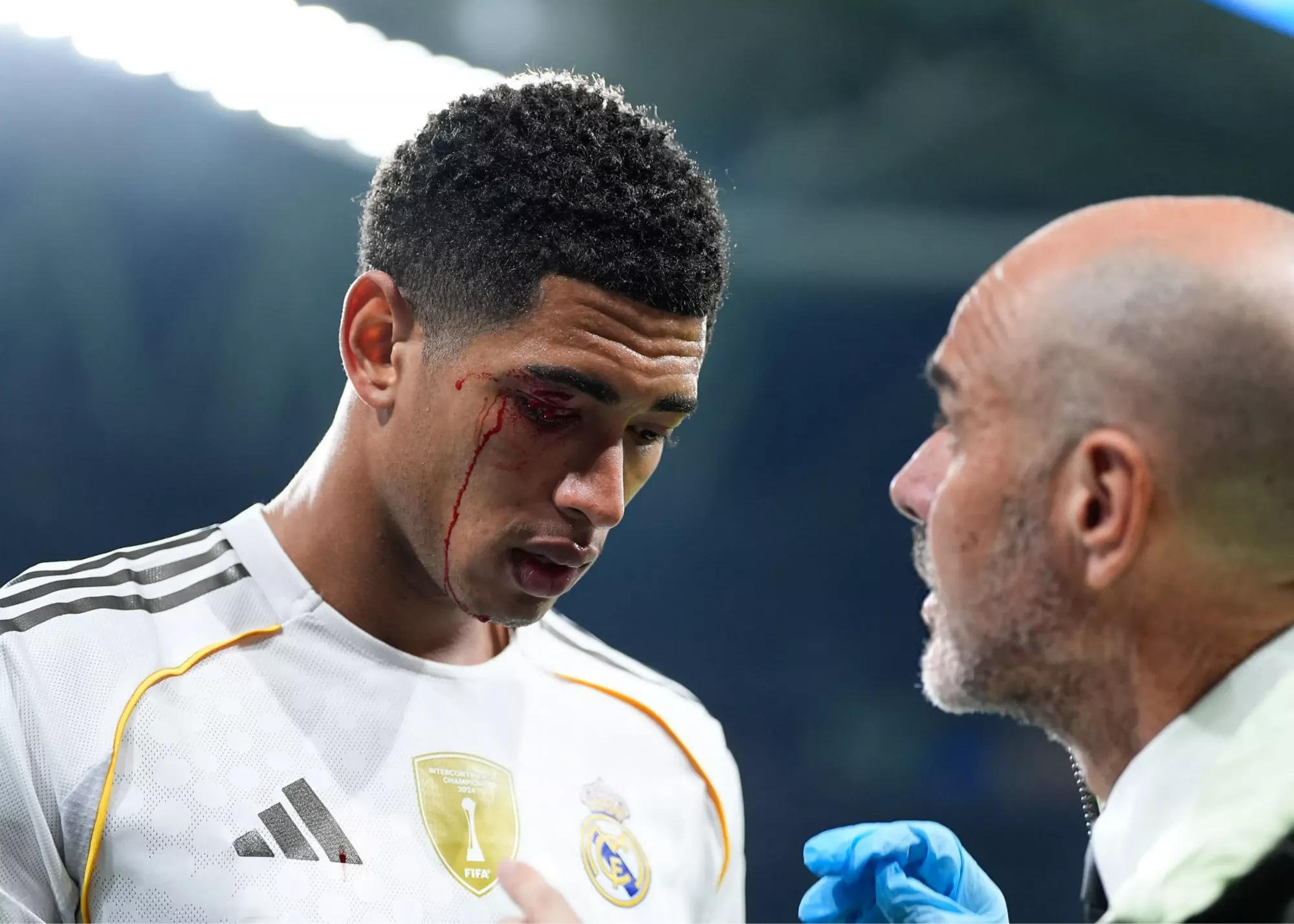 (تصاویر) چهره خونین بلینگام در شب مصیبتبار (تصاویر) چهره خونین بلینگام در شب مصیبتبار