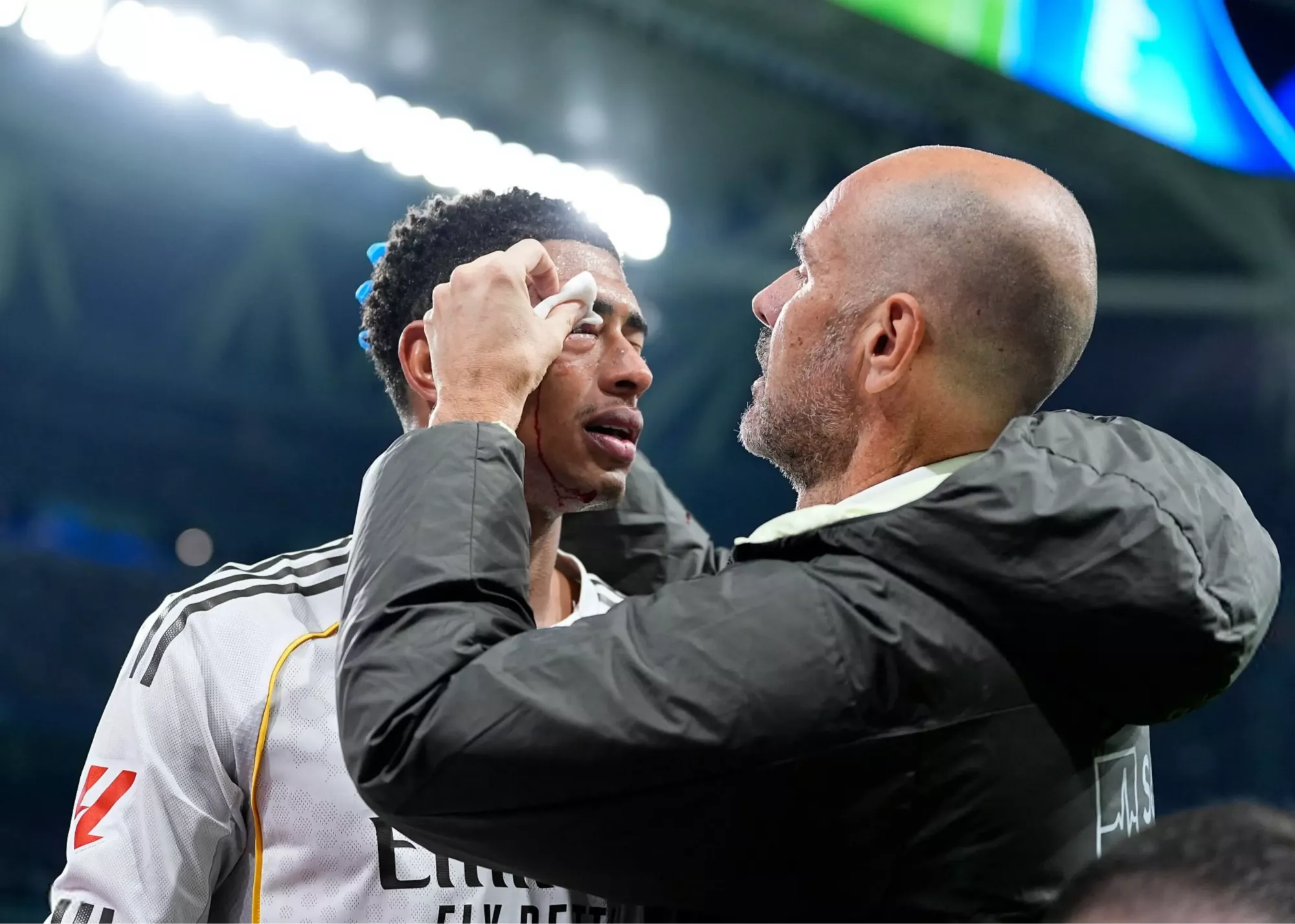 (تصاویر) چهره خونین بلینگام در شب مصیبتبار (تصاویر) چهره خونین بلینگام در شب مصیبتبار