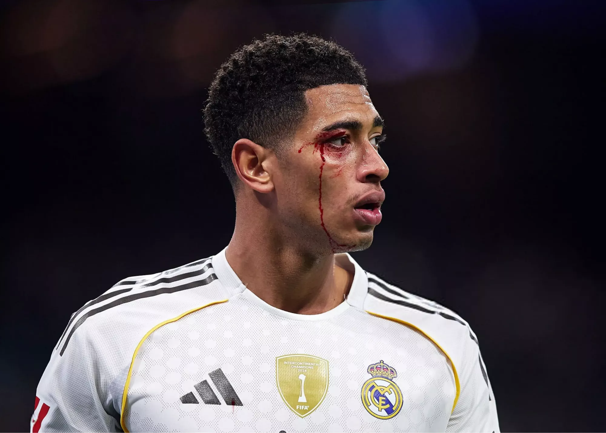 (تصاویر) چهره خونین بلینگام در شب مصیبتبار (تصاویر) چهره خونین بلینگام در شب مصیبتبار