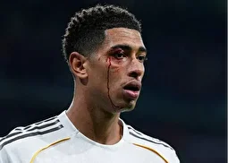 (تصاویر) چهره خونین بلینگام در شب مصیبت‌بار