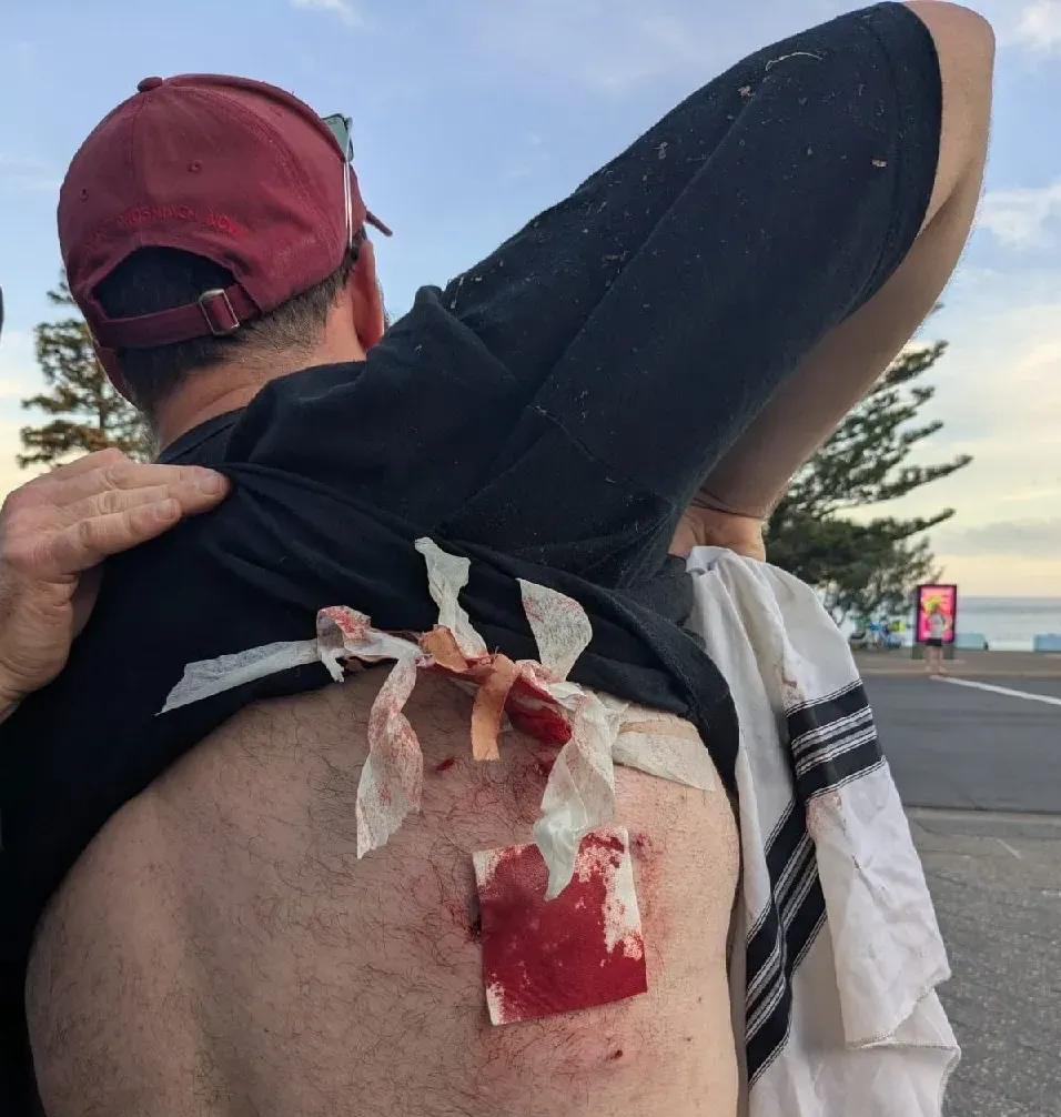 کشتار در جشن یهودیان استرالیا؛ ده‌ها نفر کشته و مجروح شدند