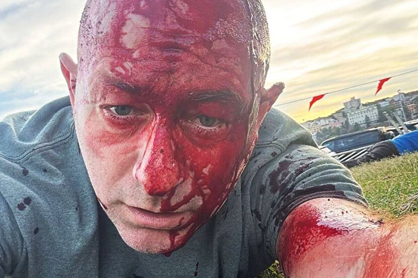 کشتار در جشن یهودیان استرالیا؛ ده‌ها نفر کشته و مجروح شدند