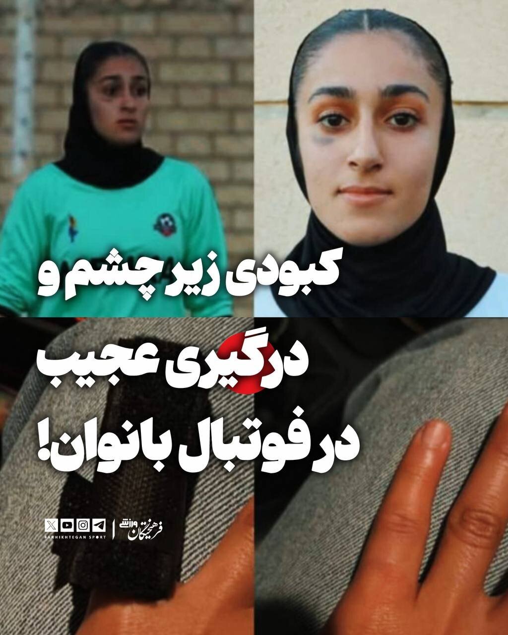 دختر پرسپولیسی زیر چشم بازیکن حریف را کبود کرد!