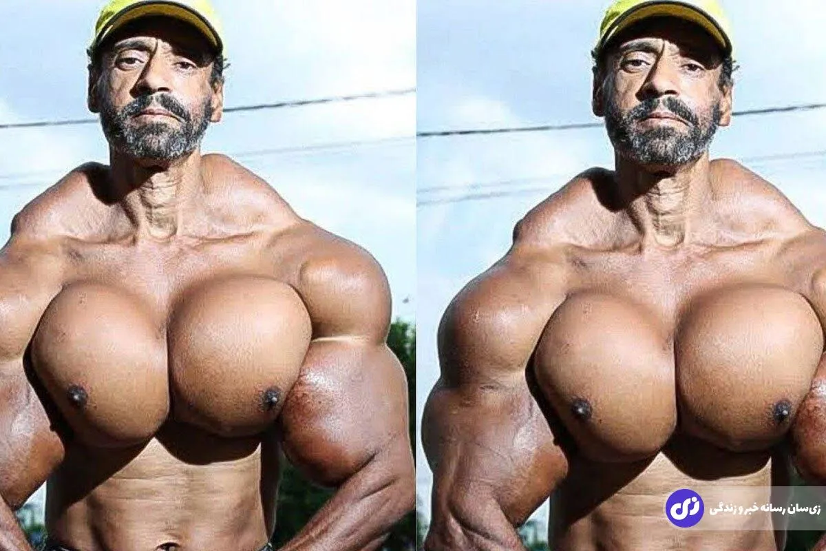 والدیر سگاتو؛ عجیب‌ترین بدنساز جهان مشهور به «سگ لاغر» که با تزریق روغن به بدنش «هالک برزیلی» شد و در تولد ۵۵ سالگی‌اش به طرز دردناکی مُرد