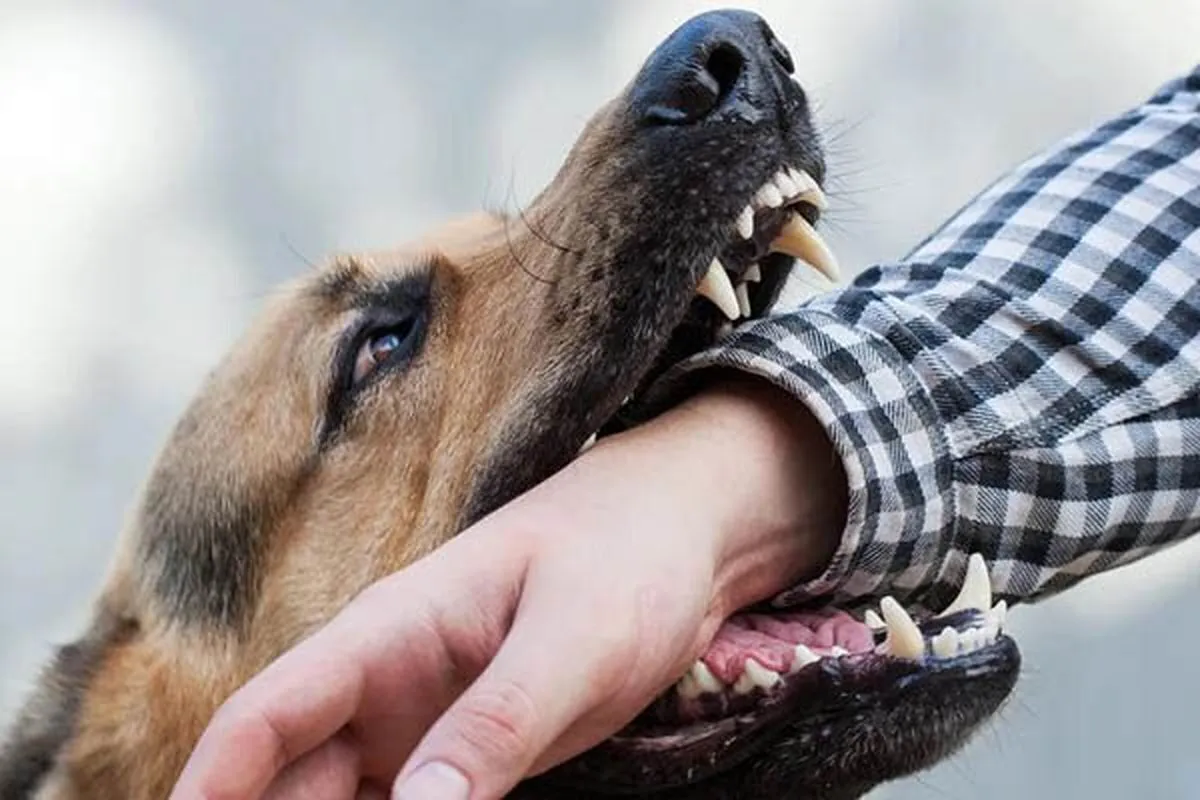 تصویر +18 | عکسی دلخراش از حمله سگ به کودک خوزستانی