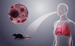 همه چیز درباره هانتاویروس: علائم، شیوه سرایت و جزئیات شیوع در کشتی تفریحی