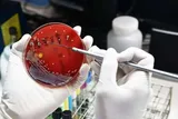 علوم پزشکی کرمانشاه: تکذیب مرگ دانشجوی دندانپزشکی بر اثر طاعون