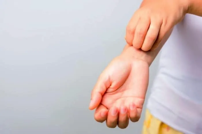 احساس حرکت حشره روی بدن نشانه کدام بیماری است؟