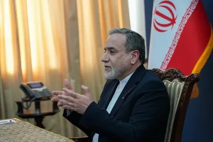 عراقچی: رهبر معظم انقلاب تنها جراحات سطحی داشته‌اند و در سلامت کامل به سر می‌برند