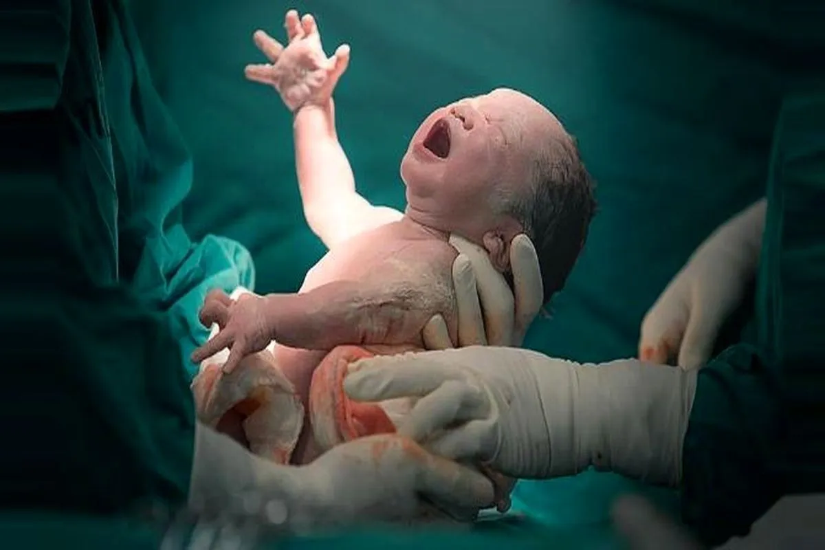 مادر اردبیلی در دومین زایمان ۴ قلو به دنیا آورد