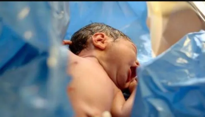 این زن افغان با به دنیا آوردن نوزادی ۴ پا همه را حیرت‌زده کرد!