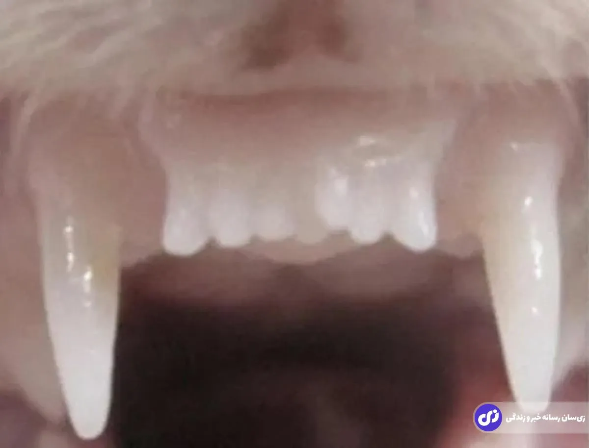 ژاپنی‌ها داروی رشد مجدد دندان را کشف کردند!