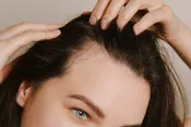 ویتامینی که مصرف آن از ریزش مو جلوگیری می‌کند